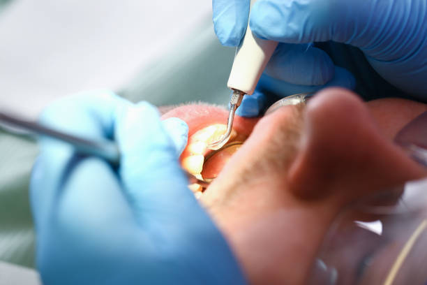 Best Emergency Denture Repair in Apex, NC