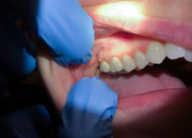 Best Emergency TMJ Treatment in Apex, NC