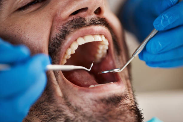 Best Weekend Emergency Dentist in Apex, NC